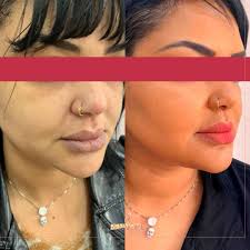 Rennove Odontologia & Harmonização facial