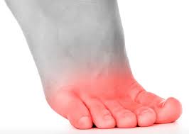 Moreover, the resulting heat and pain can be localized in the soles of feet but can also spread to the tops of the feet, the ankles, and even the lower legs. Foot Pain Diagnosis What S Causing Your Pain