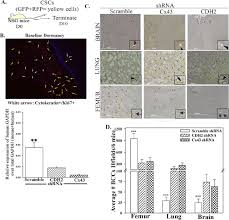 This is not a medical term. Specific N Cadherin Dependent Pathways Drive Human Breast Cancer Dormancy In Bone Marrow Life Science Alliance