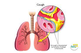 Pin On Cough Relief