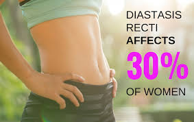We did not find results for: Diastasis Recti Everything You Need To Know