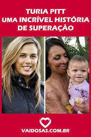 Pin On Saude E Bem Estar