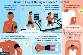 nuclear stress test uses side effects procedure results