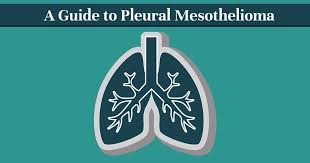 2 division of respirology, department of . Malignant Mesothelioma Types Symptoms Prognosis