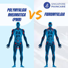 Image result for Polymyalgia Rheumatica