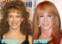 The star has been suffering from lung cancer, despite the fact that she has never been a smoker. Kathy Griffin Plastic Surgery Before And After Pictures Plastic Surgery Kathy Griffin Celebrity Plastic Surgery