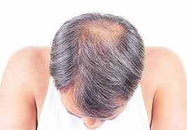 Beauty, cosmetic & personal care. Ù…Ø­ØªØ±Ù… Ø§Ù„ÙØ±Ø§Øº Ø±ÙˆÙ…Ø§Ù† Ø§Ù„Ø´Ø¹Ø± Ø§Ù„Ø®ÙÙŠÙ Ù…Ù† Ø§Ù„Ø§Ù…Ø§Ù… Ù„Ù„Ø±Ø¬Ø§Ù„ Dsvdedommel Com