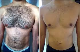 ** wow hair vanish for wome. Best Way To Remove Chest Hair Fashion Slap