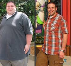 gastric sleeve success rate how much