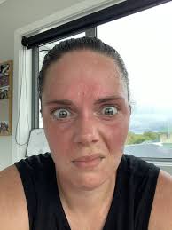 Is missing a run causing constant mental distraction?