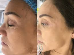 Mundo Estetico Spa y Peluqueria