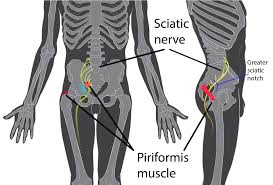 Examples of this type of muscle include. Piriformis Syndrome Wikipedia