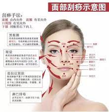 刮痧) or kerokan, is part of traditional chinese medicine (tcm) in which a tool is used to scrape people's skin in order to produce light petechiae. é¢éƒ¨åˆ®ç—§ä¸Žæ‹¨ç­‹ å…»é¢œå¦™æ‹› ç®€ä¹¦