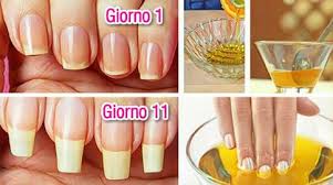 Continuando a colorarti le unghie le renderai di uno sgradevole tono giallognolo, un risultato poco sano e poco attraente. Come Far Ricrescere Unghie Sane E Forti In 11 Giorni Far Crescere Le Unghie Unghie Forti Far Crescere Le Unghie Velocemente
