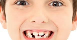 Treatment Options For Closing Gaps Between Teeth