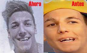 16 resultado(s) para tu búsqueda. Alexander Caniggia Mostro Sus Renovados Dientes Mira El Antes Y El Despues Ciudad Magazine