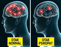 Selain itu, bulu mata dapat membantu menjaga mata tetap lembab dengan membatasi penguapan. 12 Fakta Tentang Tubuh Manusia Yang Masih Menjadi Misteri Bagi Para Ilmuwan