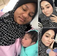 Perubahan kulit pada leher selama kehamilan biasa tidak berbahaya bagi anda atau bayi anda. Wajah Berubah Drastis Saat Hamil Wanita Cantik Ini Malu Unggah Foto Di Fb
