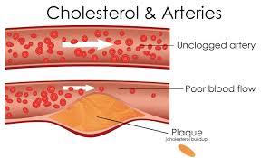 Arteries carry oxygenated and nutrient rich blood to the bodys tissues from the heart. Healthy Life Arteries Diagram Wave Magazine Online