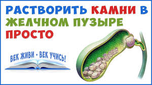 как избавиться от камней в желчном пузыре народными методами Kak Rastvorit Kamni V Zhelchnom Puzyre I Pecheni Bez Operacii Youtube