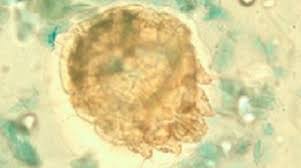 Image result for Sarcoptes scabiei