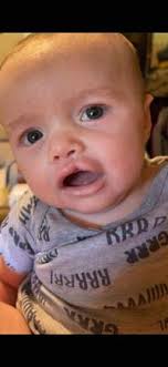 Benefit Lunch for Local Baby with Rare Genetic Disorder