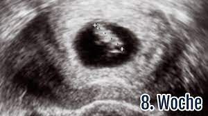 Ssw l placenta praevia l wie erzählt?! 8 Ssw Die 8 Schwangerschaftswoche Ultraschall Symptome Tipps Netmoms De