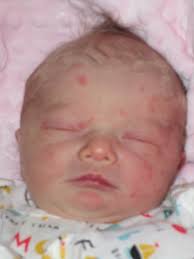 Sonic Elizabeth Flatau