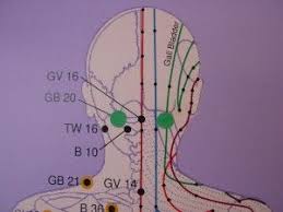 Pin On Stiff Neck