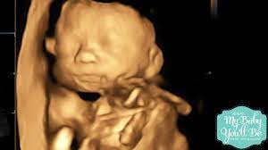 Michelle S 24 Week 3d Ultrasound Youtube