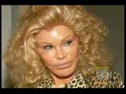 The lion woman of new york reportedly . How Significantly Plastic Surgery Did Cat Lady Jocelyn Wildenstein Have Performed Healthy Tips
