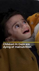 Gaza’s Health Ministry says that 15 children have died of #malnutrition in  a single hospital in northern #Gaza, in recent days.⁣, .⁣, #Israel_Gaza_war  #Israel