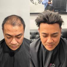 Here are 7 reasons why your hair has stopped growing and become thin. I M Facing A Thinning Hair Issue What Are The Reasons And What Can I Do