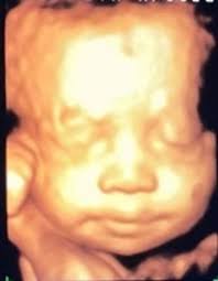 Brooklyn Nicole Williams Obituary