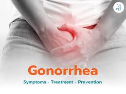 Image result for chlamydia symptoms