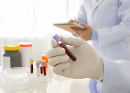 Pe okazii.ro cumperi online produse cu reducere si livrare gratuita din stoc. Cum Se Fac Analizele Cum De Nu Se IncurcÄ Probele Intre Ele De Unde Ètim DacÄ E Virus Sau Bacterie P Printesa Urbana Blog Cald De Familie
