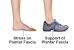 Plantar Fasciitis Shoe Inserts