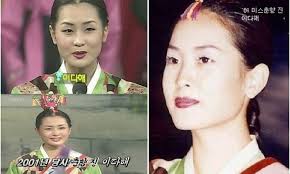 Mỹ nhân dao kéo' Lee Da Hae mỗi năm mang một khuôn mặt