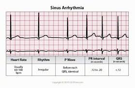 Pin On Ekg