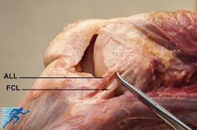 Ligament definition, a band of tissue, usually white and fibrous, serving to connect bones, hold organs in place, etc. What Is The Anterolateral Knee Ligament Minnesota Knee Specialist