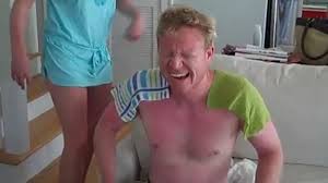 Maybe you would like to learn more about one of these? Skin Peeling From Sunburn Is Actually Your Body S Way Of Protecting You From Cancer Youtube