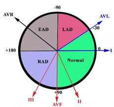 Image result for Electrocardiogram Validity