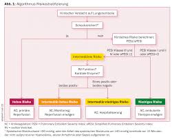 Image result for Simplified PESI