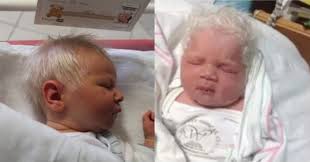 The white hair is caused by poliosis, a condition that creates a lack of pigment in the hair and mommy is beautiful and that baby is absolutely gorgeous!! A Baby Born With White Hair Is A Rare Sight Especially When He Or She Is Not Albino This Baby Born In 2015 In Hungary Had Baby Born Silver White Hair Baby