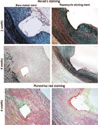 In Vitro Studies Of Duct Derived Smc Cultures Cell