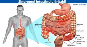 Sindromul Intestinului Iritabil Tratament Diagnostic Remedii Naturiste Alecia Ro