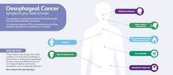 In this tumor, the cancerous cells produce bone. Symptoms And Risk Factors Of Oesophageal Cancer