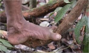Kayyman islands this is a joke. Functional Anatomy Biomechanical Performance Capabilities And Potential Niche Of Stw 573 An Australopithecus Skeleton Circa 3 67 Ma From Sterkfontein Member 2 And Its Significance For The Last Common Ancestor Of The African