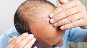 We did not find results for: Haartransplantation Haariges Handwerk Beauty Forum Germany