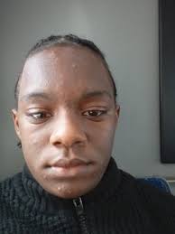 Nicholas Rash, 2580709